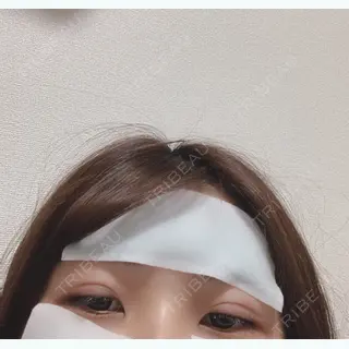 0日目の経過画像（3枚目）