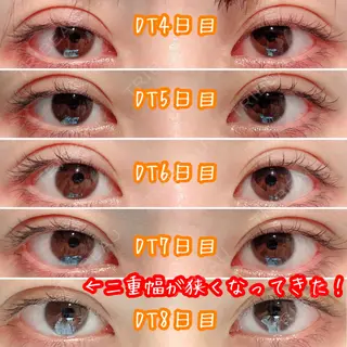 8日目の経過画像（2枚目）
