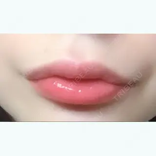 3日目の経過画像（1枚目）