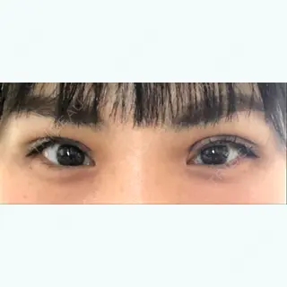 50日目の経過画像（1枚目）