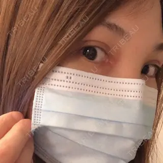 37日目の経過画像（2枚目）