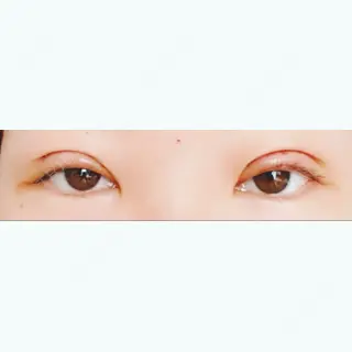 2日目の経過画像（1枚目）