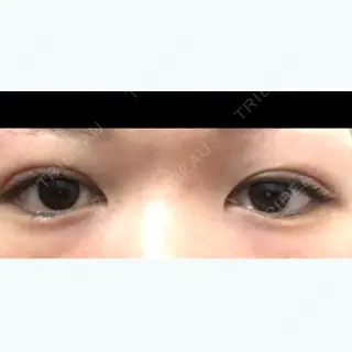 4日目の経過画像（1枚目）