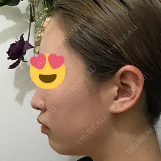 9日目の経過画像（2枚目）