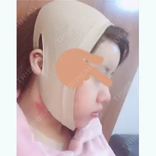 0日目の経過画像（2枚目）