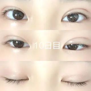 10日目の経過画像（1枚目）