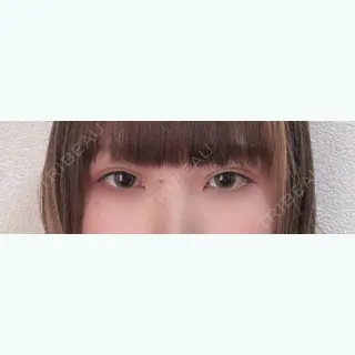 21日目の経過画像（1枚目）