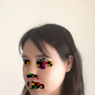 122日目の経過画像（2枚目）