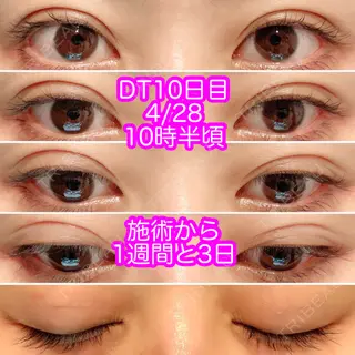 10日目の経過画像（1枚目）