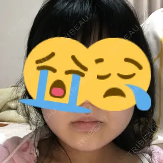 0日目の経過画像（1枚目）