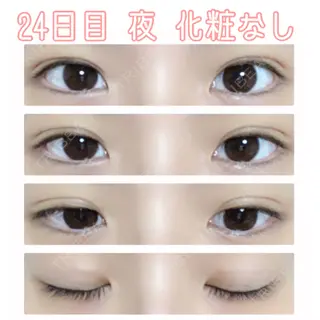 24日目の経過画像（1枚目）