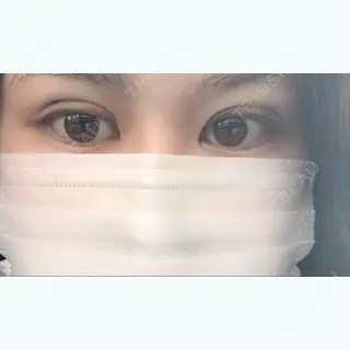 1日目の経過画像（1枚目）