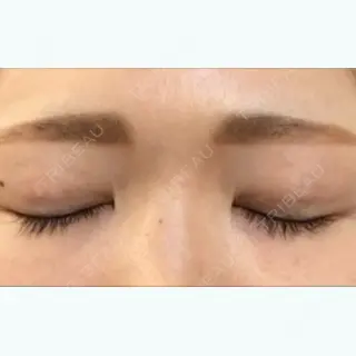 8日目の経過画像（2枚目）