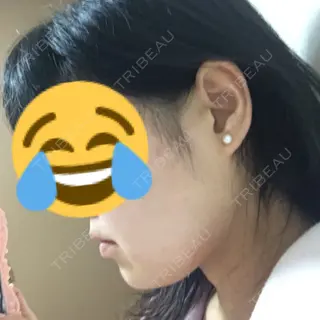 1日目の経過画像（2枚目）