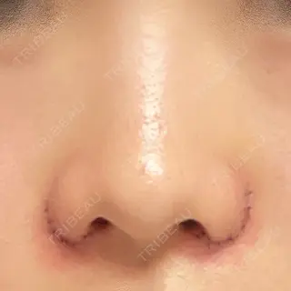 2日目の経過画像（1枚目）