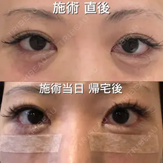 0日目の経過画像（2枚目）