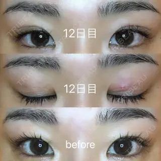 12日目の経過画像（1枚目）
