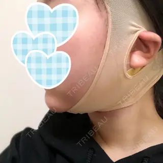 0日目の経過画像（2枚目）