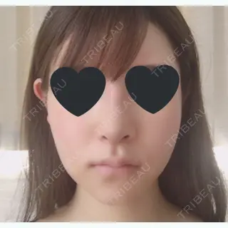 8日目の経過画像（1枚目）