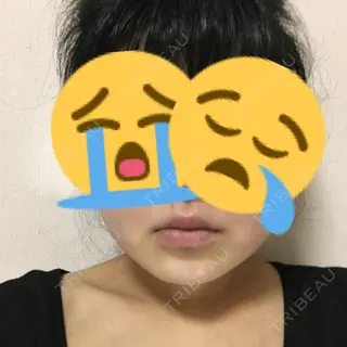 3日目の経過画像（1枚目）