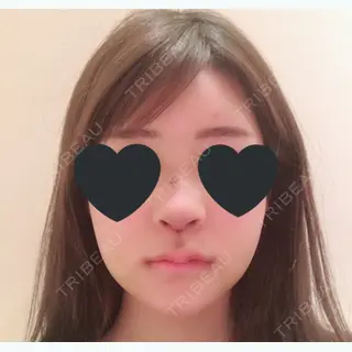 5日目の経過画像（1枚目）