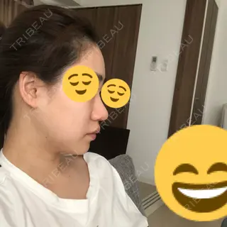 142日目の経過画像（2枚目）