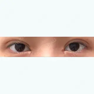 7日目の経過画像（1枚目）