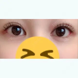 21日目の経過画像（1枚目）
