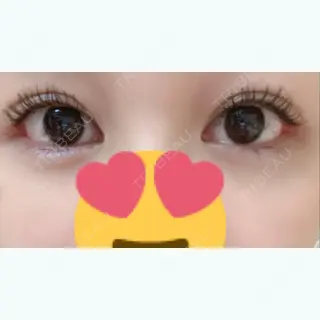 23日目の経過画像（1枚目）