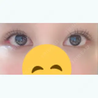 24日目の経過画像（1枚目）