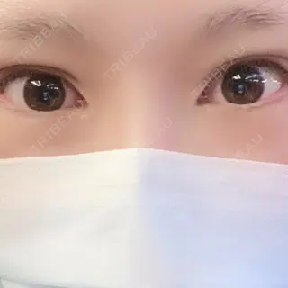 0日目の経過画像（2枚目）