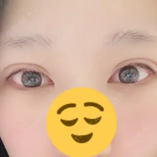 1日目の経過画像（1枚目）