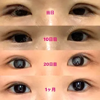 30日目の経過画像（2枚目）