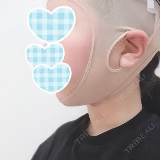 2日目の経過画像（2枚目）