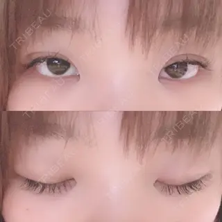 19日目の経過画像（1枚目）