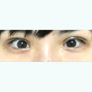 57日目の経過画像（1枚目）