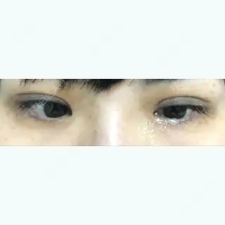 57日目の経過画像（2枚目）