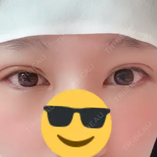 2日目の経過画像（1枚目）