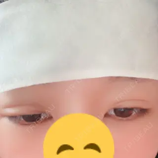 2日目の経過画像（3枚目）