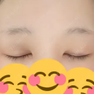 2日目の経過画像（2枚目）