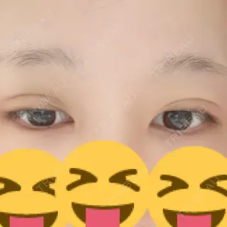 2日目の経過画像（3枚目）
