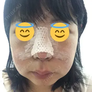 3日目の経過画像（1枚目）