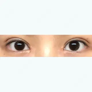 13日目の経過画像（1枚目）
