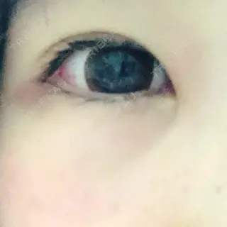 2日目の経過画像（1枚目）