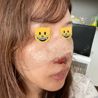 2日目の経過画像（2枚目）