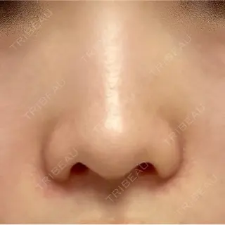 9日目の経過画像（1枚目）