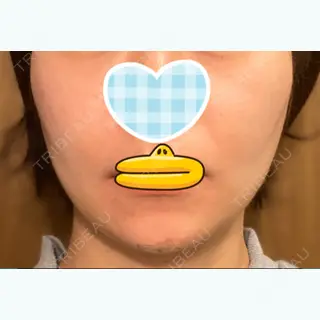 1日目の経過画像（2枚目）