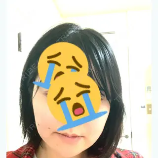 105日目の経過画像（1枚目）