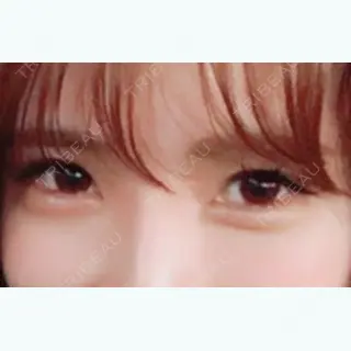 31日目の経過画像（1枚目）