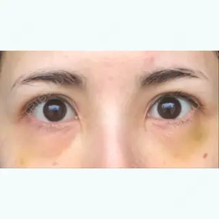 9日目の経過画像（1枚目）